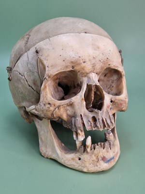 Lot 1304 - A human skull articulated for medical studies...